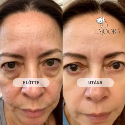 Glow Eye Lift Duo — Vörösfény és EMS szemkörnyék-feszesítő