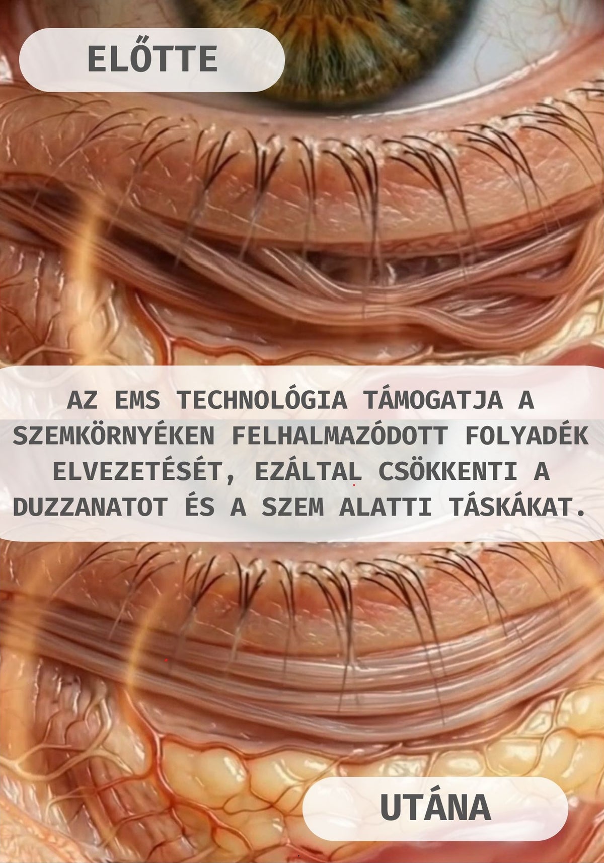 Glow Eye Lift Duo — Vörösfény és EMS szemkörnyék-feszesítő